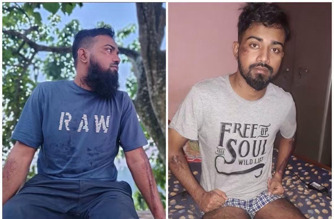 দুই পা হারিয়েও থামেননি শাহিন, চাকরির লড়াইয়ে মিলল আশার বার্তা